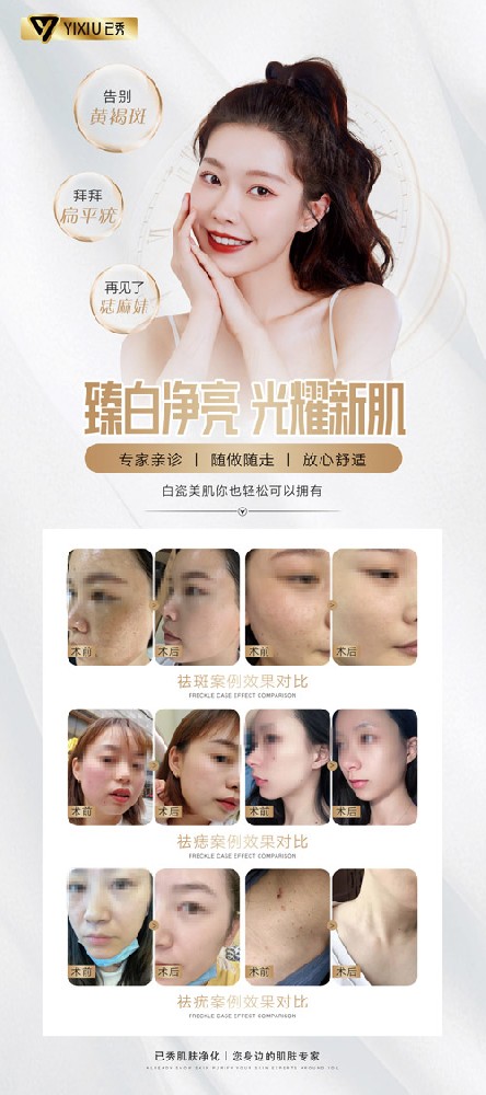 附近哪有已秀瘦身店